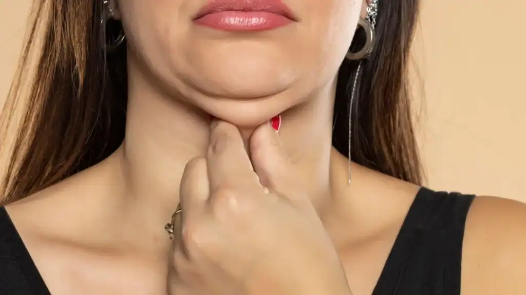 An image of a woman with double chin, sad, worried : Non Surgical Double Chin Removal Treatment in Warminster, UK