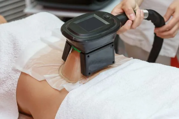 Image of person having fat freezing treatment to help weight gain Warminster