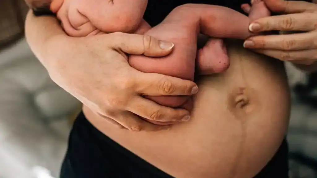 Why Is My Stomach Still Big After Pregnancy Warminster?
