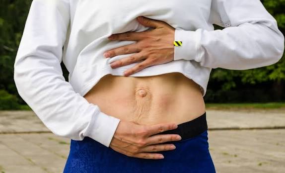 When Could Diastasis Recti Be the Missing Piece of the Puzzle Warminster?